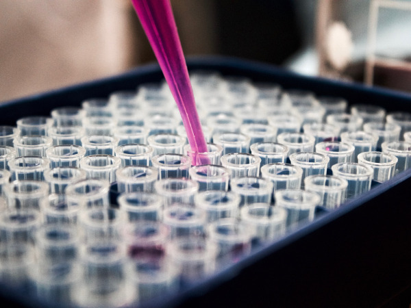 IVF-Reproductive Technology